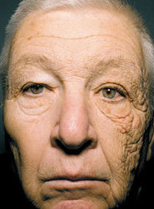 Truck drivers face damaged by sun